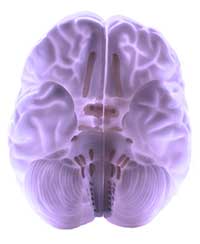Brain Vascular Lesions by OC Neurological Institute - Brain Vascular Lesions
