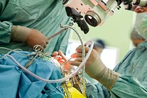 Minimally Invasive Surgery by OC Neurological Institute 2 1 300x200 - Minimally Invasive Surgery