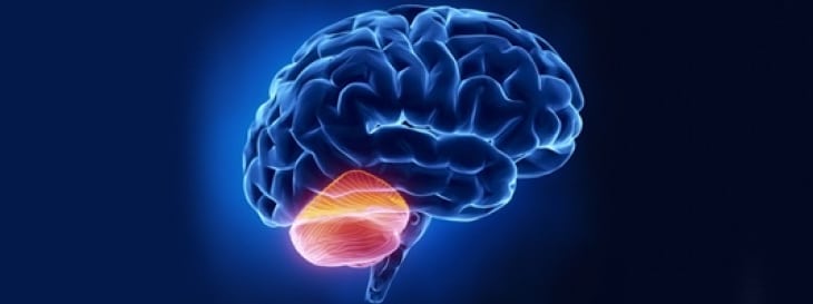Understanding Chiari Malformations Orange County Neurosurgical Institute - Understanding Chiari Malformations